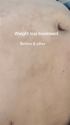 Nepal China skin care (@nepalchinaskincare2)’s videos with original sound - 𝑺hekhar𝑩ajracharya𝑶fficial✅