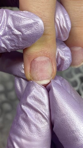 Short Nail Reconstruction Tutorial