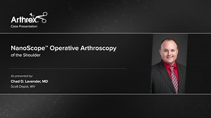 NanoScope™ Operative Arthroscopy of the Shoulder