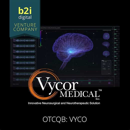 Vycor’s NovaVision division. NeuroEyeCoach is a computer-based program designed to help