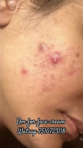 facecream msg for order 7510723118 #youthface #fyp #beauty #love