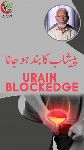 20K views · 231 reactions | Click here To Buy:...