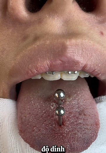 #piercing #piercinglovers #piercingstudio #safepiercing #xuhuongtiktok #piercingcheck #2025 #lindtbodypiercing #fyp #tonguepierceing #piercer #pierced #piercingideas