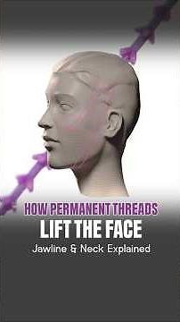 How does a Scarless Non Surgical Facelift Work? Permanent Threads