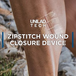 638K views · 2.8K shares | This device enables you to treat minor cuts with hospital-grade technology! 啕 | UNILAD Tech | Facebook