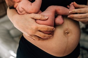 Your body after baby: The first 6 weeks