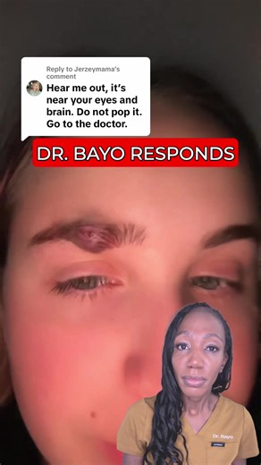 Why You Shouldn't Pop Facial Abscesses or Cysts