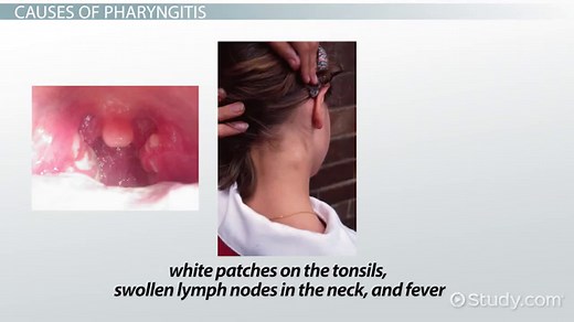 You must c C reate an account to continue watching