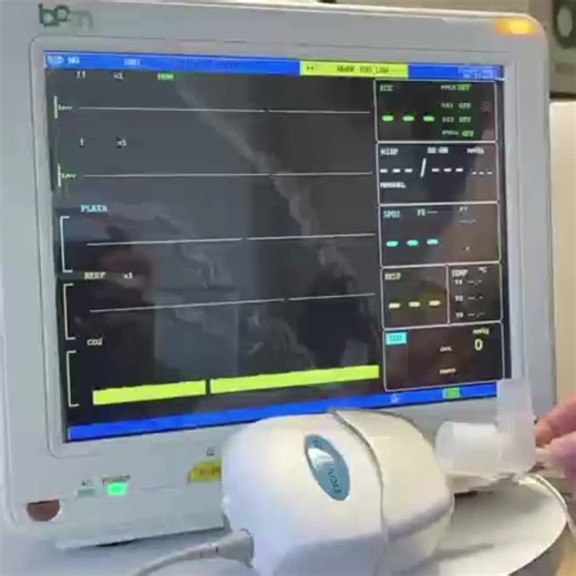 Vet Vital signal Monitor Portable Animal Medical Patient Multiparameter Pet Monitor for Vet Veterinary Use