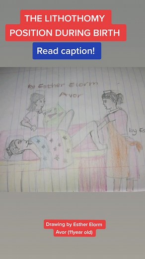 THE LITHOTOMY POSITION - COMMON BIRTH POSITION For many women within their Reproductive years, this picture brings so many memories. Especially in settings where women are given no options during birth but to lie on your back. This position is called the lithotomy position. It involves lying on your back with your legs flexed 90 degrees at your hips. Your knees will be bent at 70 to 90 degrees, and padded foot rests attached to the table will support your legs. Its benefit during labor include 1