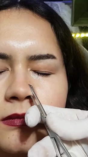 1.2M views · 4.5K reactions | nose piercing video. #nosepiercing #nosepiercings #piercingeducation #piercingprocedure #piercingcare #piercinglovers | piercing.world | Facebook