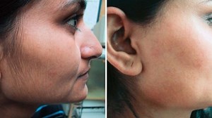 Remediul natural facut in casa care te scapa de parul de pe fata! Fara durere, ieftin si eficient