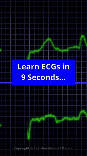 Nurse Sarah on Instagram: "Learn ECG interpretation the easy way. I have a free series on my YouTube channel that breaks down the details on how to identify rhythms, parts of the waveform, top rhythms to know, and more.. I also have my notes summarized in my ECG guide that can save you time and help you learn key concepts about ECG interpretation fast. Study Guide at: NurseSarah.com #ecg #ekg #nursing #nursingschool #nursesarah #nurses #nurse #heart #health #education #study #nursingstudent"