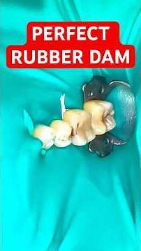 Rubber Dam Placement Step by Step (PROTOCOL Every Dentist Should Know)