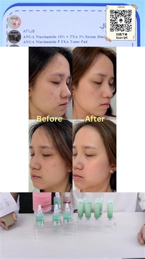 先告知大家注意事项： ✅anua套组卖完！品牌明天才能update是否可以加货 🙏🏻 一旦确Anua后 我们会在telegram & IGS 公布‼️ ✅anua 千万不要不要在单买那里去加两支⚠️ 是不对的！也不会得到赠品的‼️要买套组的需要等明天才能update ‼️ ✅24HRS 内衣网站看不好意思！需要麻烦大家用不同browser下单 一直尝试～ 如果遇到你选的订单一直乱乱变，付款一直不能 建议大家等明天才下单 因为品牌方需要询问 IT的帮忙 #非常抱歉品牌的网站很多问题 🙏🏻 1)购买24HRS内衣（点击链接下单） 👉🏻 https://fashionforyes.gogoli.app/shop/event?id=87f2c975-d488-42e5-80ea-530b189ddf1c 【购买2件/10件 请选对套组 价钱正确才下单‼️】 品牌客服ig：https://www.instagram.com/24hrs_marketing?igsh=eGd4cnd2bDRxZmJu 2)购买DODUM（点击链接下单！） 👉🏻 https://wholesomeli