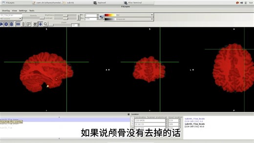 磁共振预处理系列1-创建大脑mask