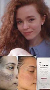 glutamax whitening cream|pigmentation treatment|skin whitening cream|best whitening cream|skin glow