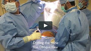 OTA Video Library - The Anterior Pelvic Internal Fixator "INFIX" Technique - Rahul Vaidya, MD