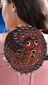 Treatment for severe maggot infestation on the backside #amar_asmr879 #asmrvideo part 1 | Asmr Sakir Medical