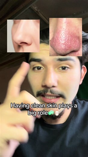 Mud mask is the method, thank me later! #skincare #acne #skincareroutine #mudmask #fyp
