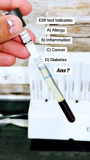 Understanding ESR Test Results in Medicine