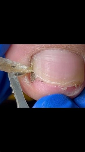 Satisfying pedicure video! #pedicure #toenails