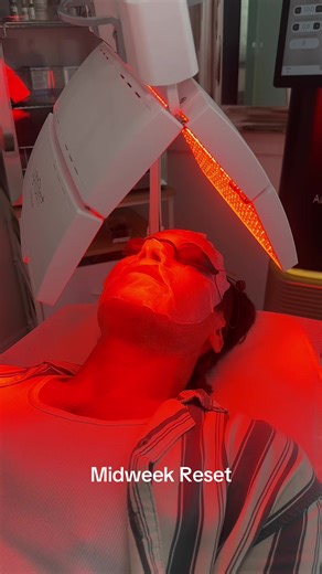 Alma Hybrid Laser: Transform Your Skin at Giffen Health