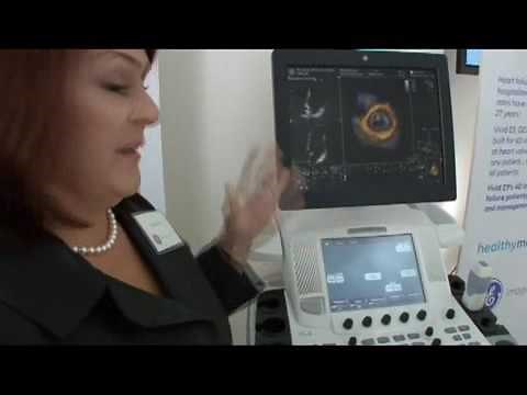 GE VIVID E9 Advanced Cardiac Ultrasound Imaging 4D Heart Imaging