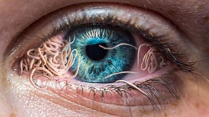 Discover 6 worms that may reside in your body