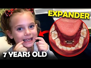 Getting an expander at 7 years old! Everything you need to know...