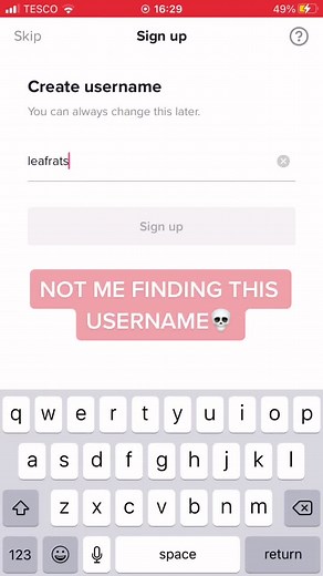 OMG #funny #rare #username #fyp #remoterats