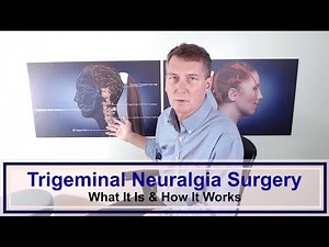 Trigeminal Neuralgia Surgery | What It Is & How It Works