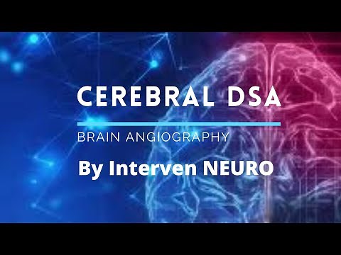 001 DSA Cerebral Angiography