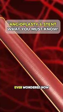 Angioplasty & Stent Placement: A Quick Guide for Med Students #CardiologyBasics #hearthealth #meded