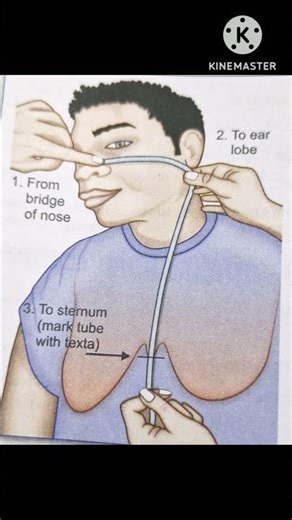 measurement of RT ✅️ #shortfeed #nurse #shorts #medical