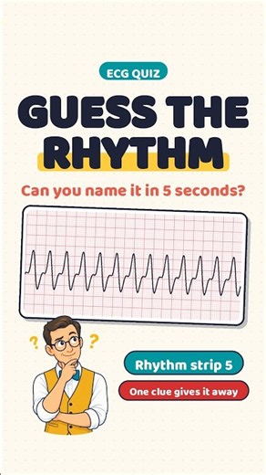ECG Rhythm Quiz: Can You Name It in 5 Seconds? (Strip 5)