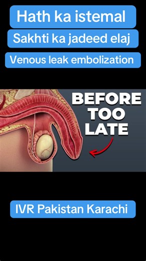 Venous Leak Embolization in Karachi: Dr. Vicky Kumar