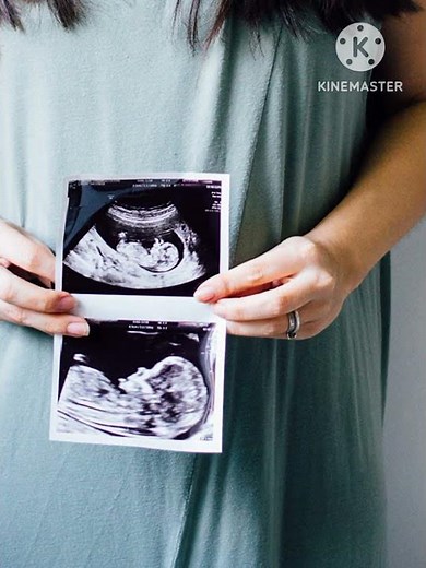 AFI/ Amniotic fluid index in pregnancy ultrasound! #kanhaladiescare #pregnancyultrasound