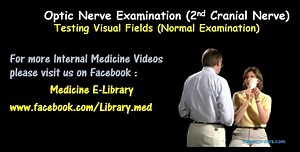 15 reactions · 23 shares | Video : Checking Visual Fields in a normal...
