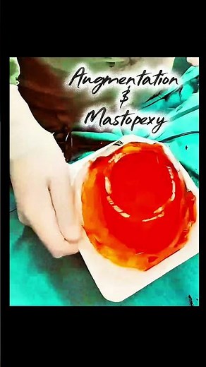 Augmentation & Mastopexy