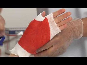 Anlegen eines abnehmbaren Daumenverbands mit Delta-Cast® Soft