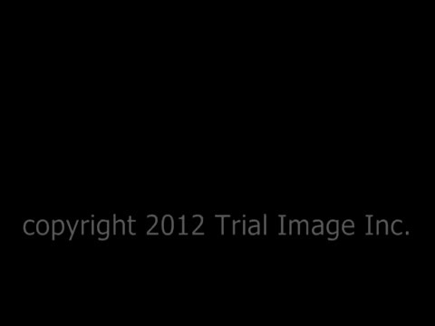 【搬运工】Billroth 2 Surgery video 毕二式胃大切手术示意视频 无声音