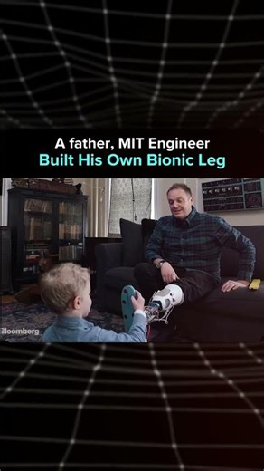 A father Built His Own Bionic Leg