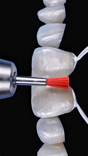 Стоматология | Зубной Техник | Москва on Instagram: "@robertolopez_co @arturio_dent - лектор в сфере съёмного протезирования @zirconium_line - циркон, который не надо сажать и красить и очень прочный на изгиб композит @yakoub.awanes - dental technician UAE - Abu dhabi @dentalfork - лучшие книги и инструменты для стоматологии @vivans_dens - опинион лидер ivoclar"