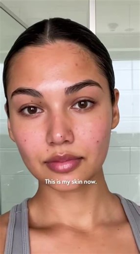 ‏Feeling alienated change your skin care routine link in bio