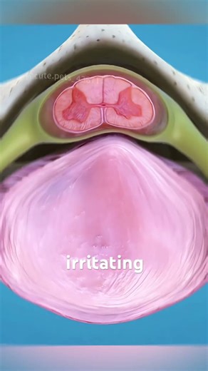 Spinal Fusion Surgery! (3D Animation)#spinalfusion #spinesurgery #backpainsurgery #orthopedics