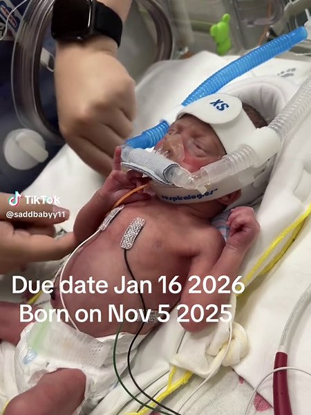 My Little Premie Ladybug @joeyhernandez782 Our little girl ❤️🥹🙏 | 30 weeks pregnant