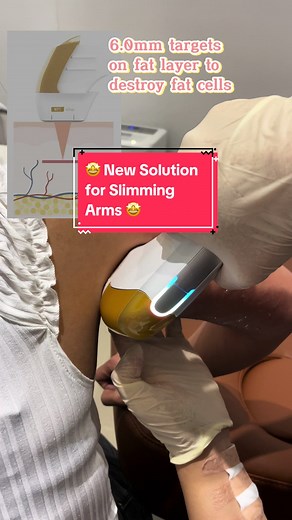 🤩 New Solution for Slimming Arms 🤩 HiFu has a secret 🤫 It can destroy fat cells and tighten your arms 💪 #hifumpt #hifu4d #ultraformer4 #ultrasoundtreatment #noninvasive #stimulatecollagen #tighteningskin #minimizewrinkles #youthfulskin #smaslayer #destroyfatcells #ofwtaiwan #pinoytaiwan #tiktoktaiwanph #pinoytaiwantiktoker #ofwtaipeitaiwan🇹🇼🇵🇭 #ofwtaichungtaiwantiktokers🇹🇼 #taipeiclinic #taoyuanclinic #zhongliclinic #taichungclinic #ang_unang_pinoy_clinic_sa_tw #angunangpinoyaesclinic 