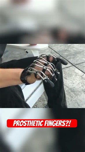 How This Device Lets Amputees HOLD a Coffee Mug Again