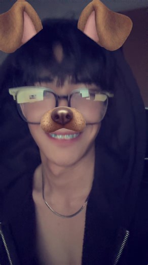 i got called braceface #fyppppppppppppppppppppppp